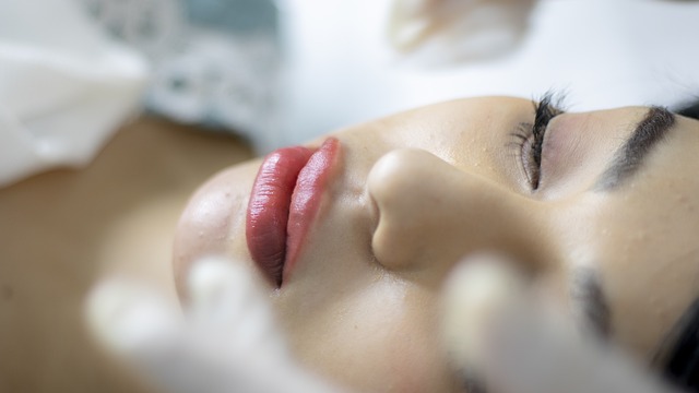 Facial Fillers