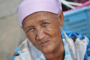 Non-Invasive Skin Lifting: Gentle Wrinkle Reduction for Youthful Results