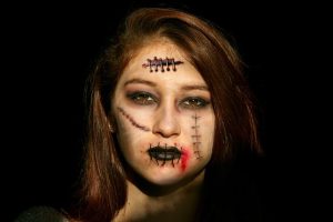 Morpheus8: Revolutionizing Acne Scar Reduction for Smooth, Clear Skin