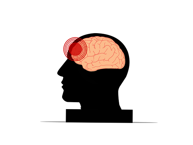 Botox for Migraine Relief
