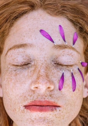 Laser Facials: Unlocking Radiant Skin with Advanced Technology