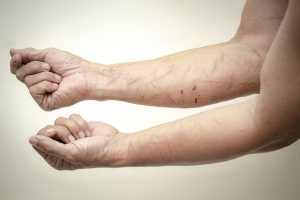 Patient Story Campaigns: Engaging Plastic Surgery Marketing Strategies