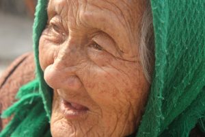 Morpheus8: Safe, Non-Invasive Wrinkle Reduction for Delicate Skin