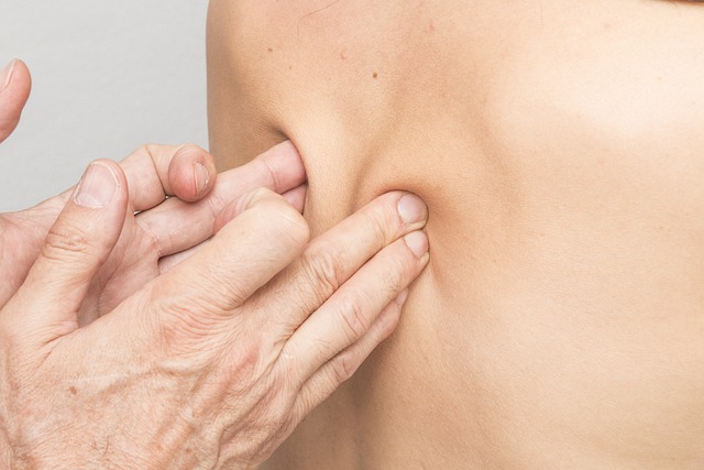 CBT therapy