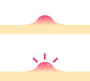 Laser Skin Brightening: Science, Safety, and Results for Effective Treatments