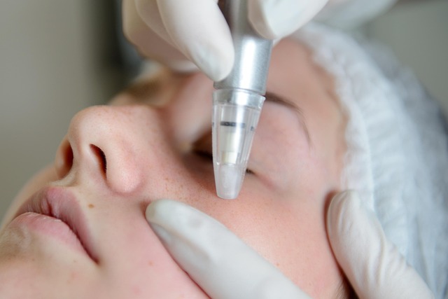 Laser Skin Treatments