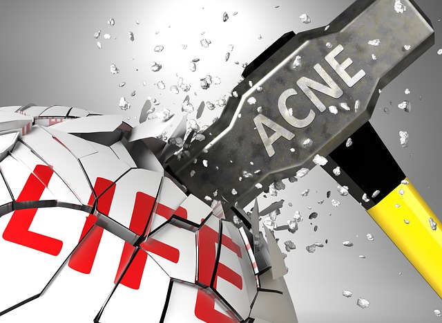 Acne Scar Reduction with Morpheus8