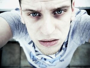 Botox for Crow’s Feet: Preventing Forehead & Frown Line Wrinkles