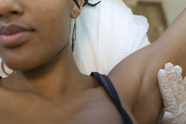 Permanent Hair Removal