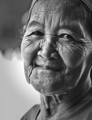 Non-Invasive Skin Lifting: Revolutionizing Wrinkle Reduction for Face & Body