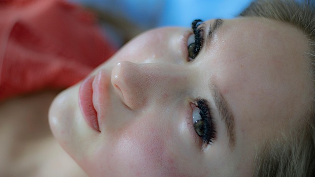 Acne Scar Reduction with Morpheus8