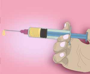 Botox Injections: Unlocking Non-Invasive Facial Sculpting Secrets