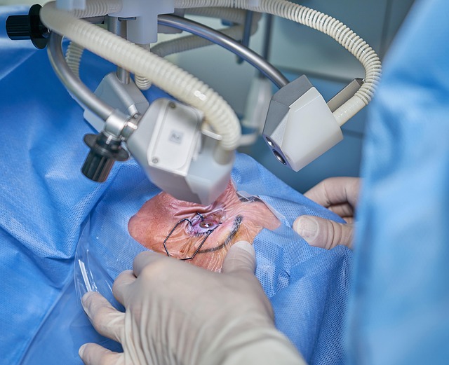 CoolSculpting Procedure