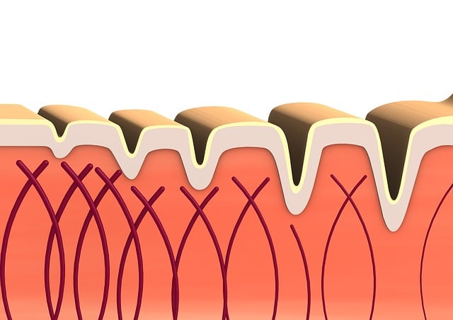 Morpheus8 Collagen Boosting