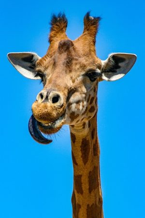 Morpheus8 Neck Tightening: Revolutionize Your Neck’s Aesthetic with RF Microneedling
