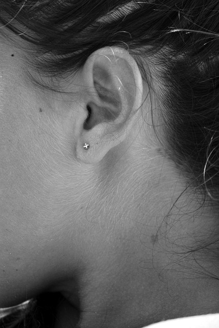 Morpheus8 Neck Tightening