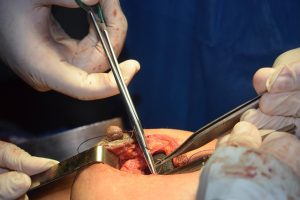 Mastering Plastic Surgery Marketing: Targeted Social Media Ads Guide