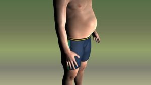 Semaglutide for Obesity: A Comprehensive Guide to Efficacy and Safety