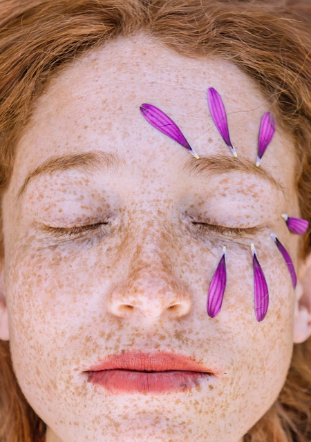Skin Tightening with Morpheus8
