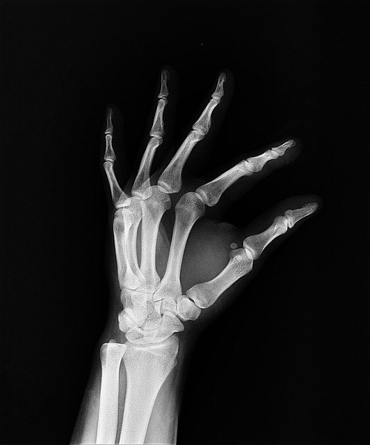 Workers’ Compensation Insurance
