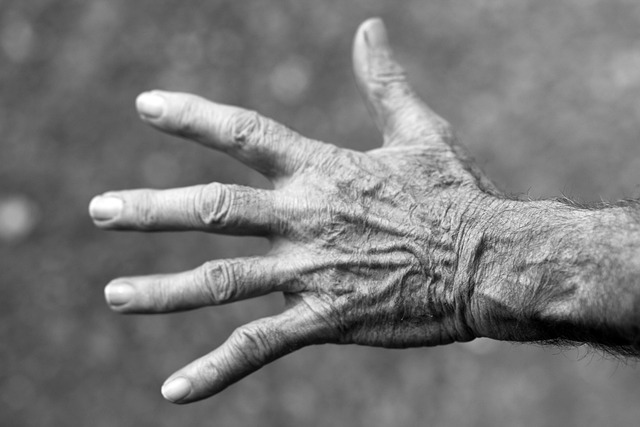 Wrinkle Reduction with Morpheus8