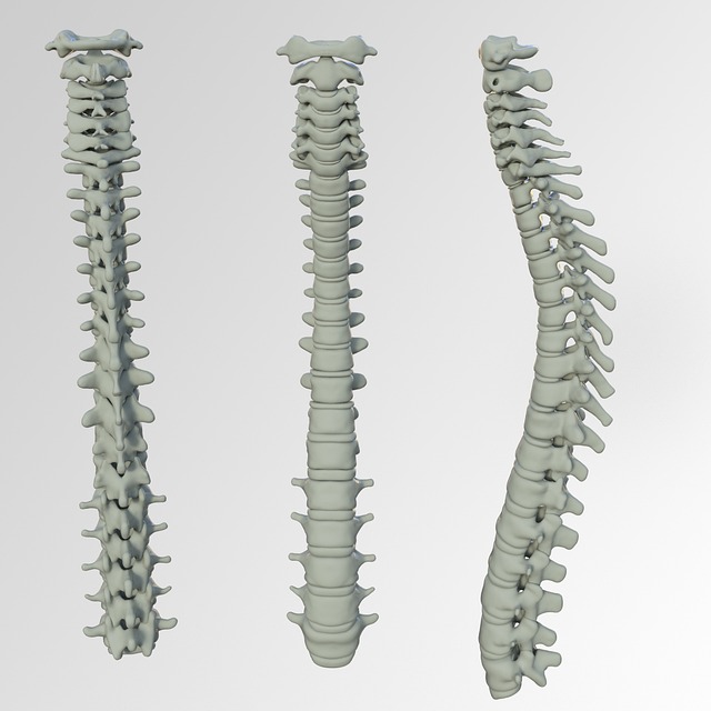 acupuncture for back pain