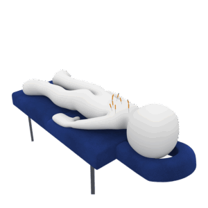 Acupuncture Near Round Rock: Optimizing Local Searches for Relief