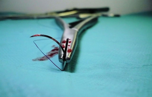 CoolSculpting Procedure