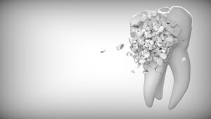 Protect Your Dental Practice: Comprehensive Guide to Dentist Malpractice Insurance