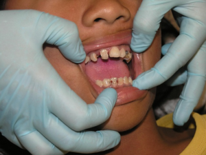 Unleash Youthful Radiance: Exploring Non-Surgical Botox Treatments