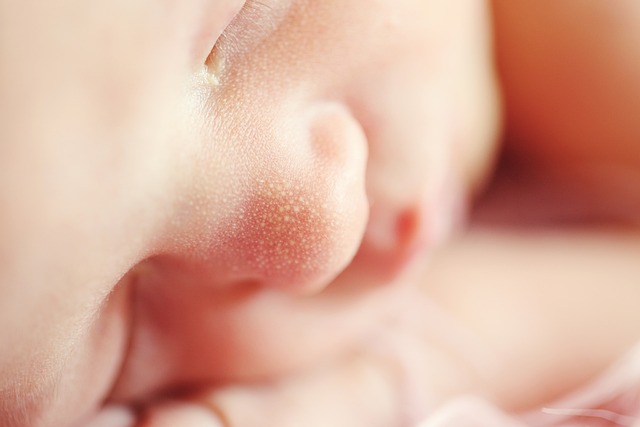 RF Skin Resurfacing