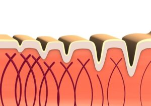 Unveiling Long-Lasting Beauty: A Comprehensive Guide to RF Skin Resurfacing