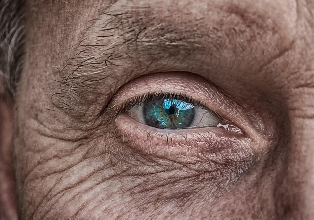Skin Tightening with Morpheus8