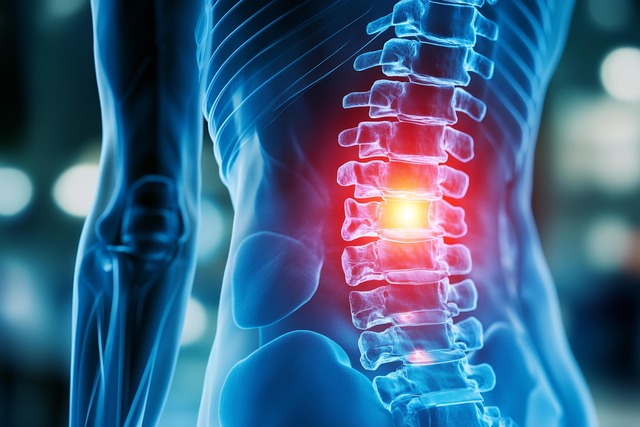 acupuncture for back pain