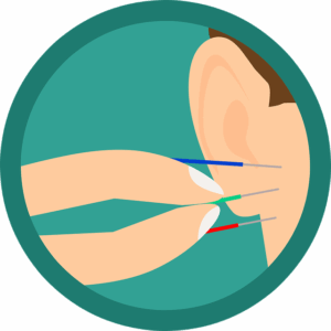Acupuncture in Round Rock, TX: Unlocking Local Search Trends and Patient Preferences