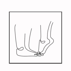 Botox for Crow’s Feet & Smile Lines: Comprehensive Guide to Wrinkle Reduction