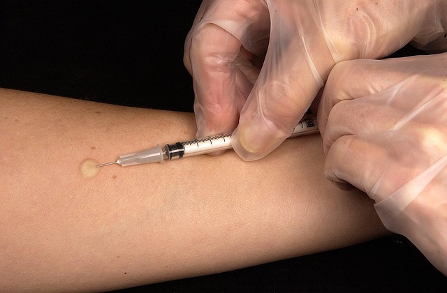 Botox Injections