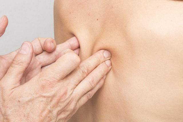 CBT therapy