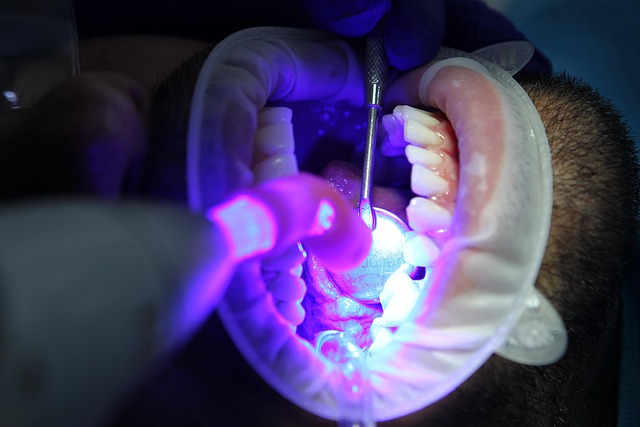 CoolSculpting Procedure