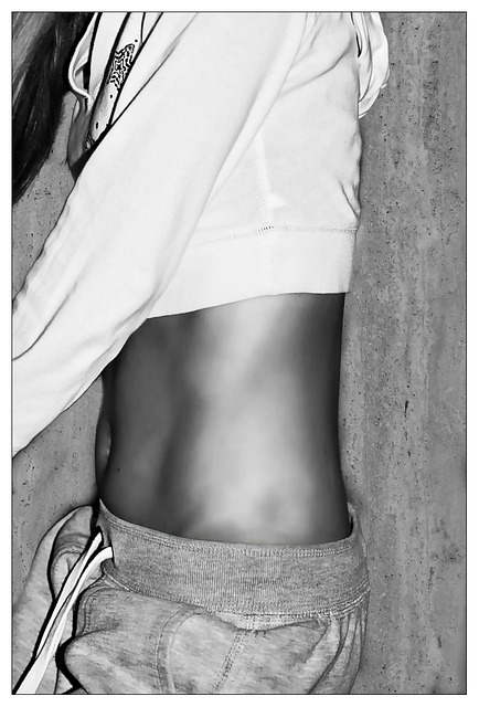 CoolSculpting tummy