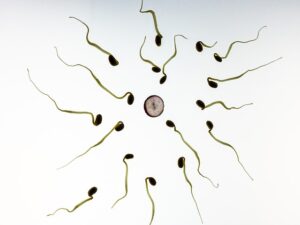 CoolSculpting: Freezing Fat for Long-Term Cell Reduction Results