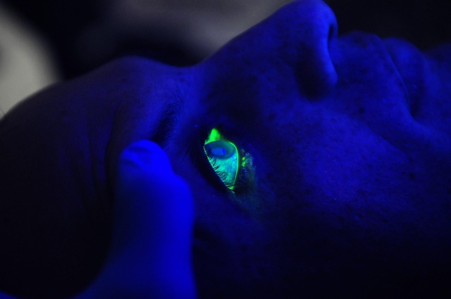 Laser Skin Treatments