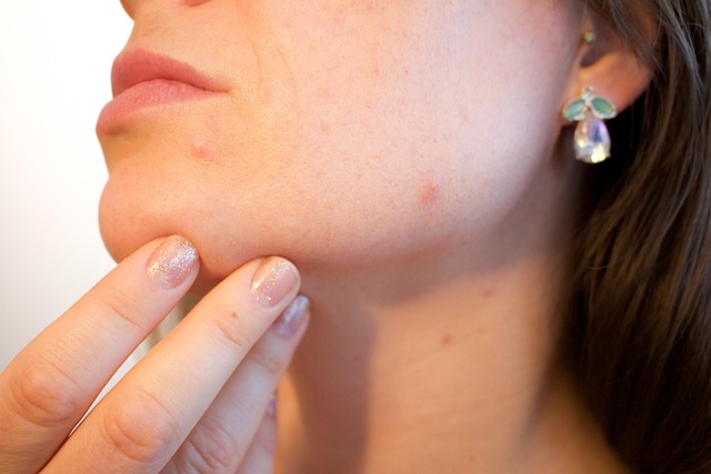 Morpheus8 Facial Treatments
