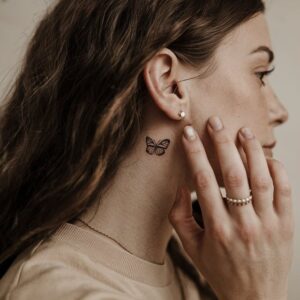 Morpheus8 Neck Tightening: Affordable, Non-Surgical Solution for a Firmer Neck