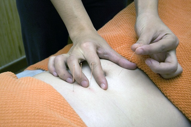 reproductive acupuncture