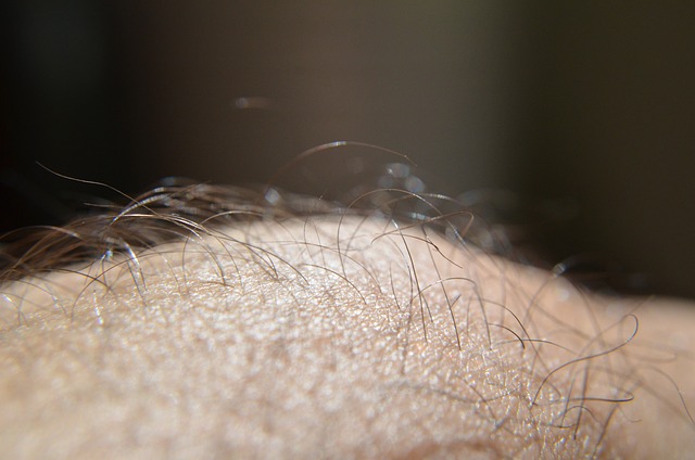 RF Skin Resurfacing