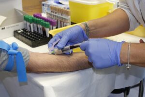 CoolSculpting: Non-Invasive Thigh and Arm Fat Freezing Solution