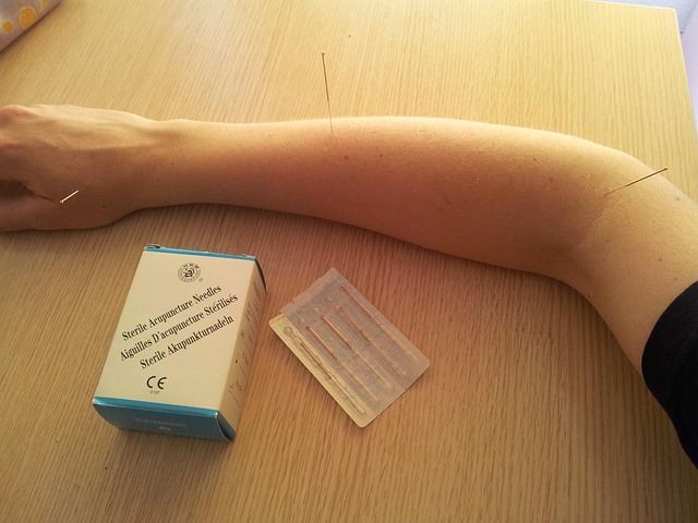 acupuncture-for-infertility-640x480-4803454.jpeg