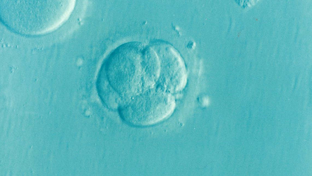 acupuncture for infertility