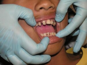 Non-Invasive Cosmetic Solutions: Exploring Popular Aesthetic Treatments